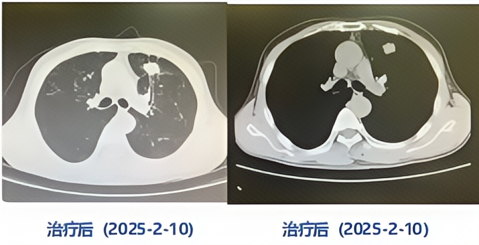 美图设计室变清晰_2025_04_03.png
