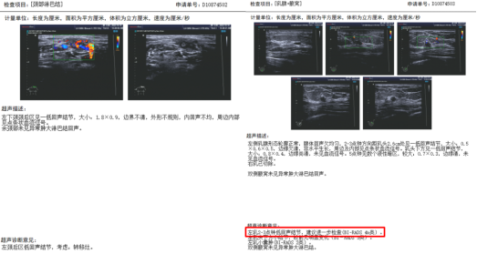 【张伟纯病例】双口服方案护航长生存！长春瑞滨节拍化疗联合吡咯替尼助力HER2阳性乳腺癌实现15个月PFS(1)1764.png