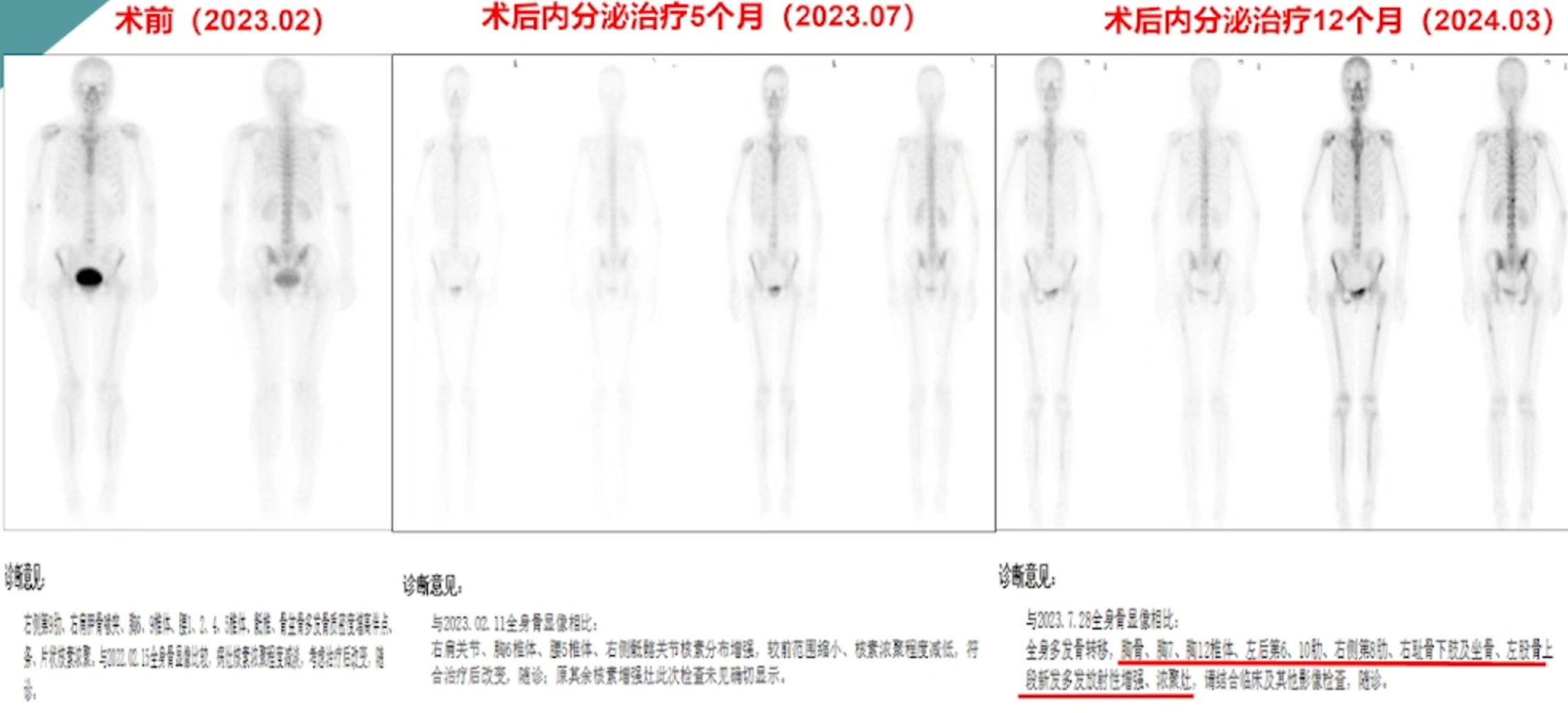 病例诊疗过程概览.png