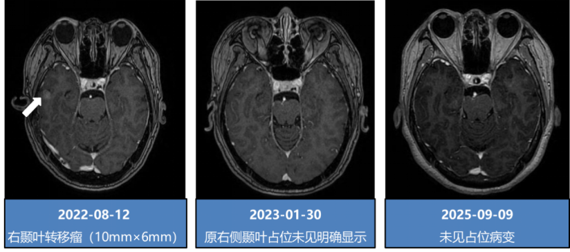 31666b8b6cb9d1322c112e60280fc4ed_ca8211f1c2841596197a9b81ff102f70_81562.png 31666b8b6cb9d1322c112e60280fc4ed_ca8211f1c2841596197a9b81ff102f70_81562.png