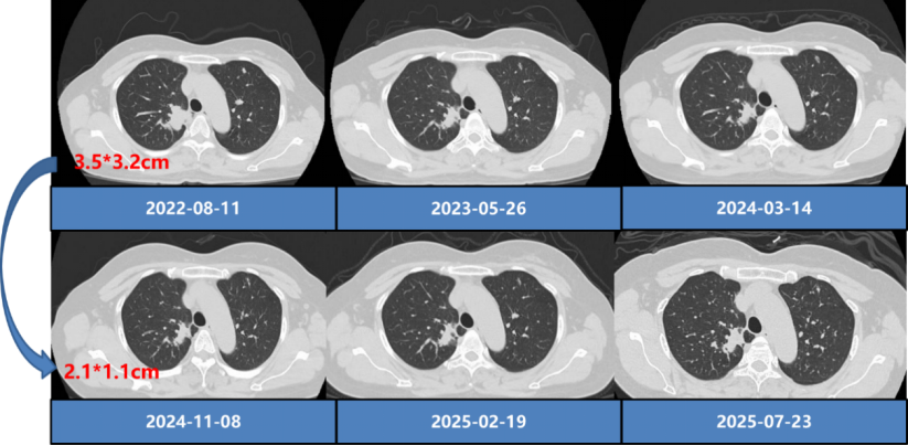 31666b8b6cb9d1322c112e60280fc4ed_ca8211f1c2841596197a9b81ff102f70_81555.png 31666b8b6cb9d1322c112e60280fc4ed_ca8211f1c2841596197a9b81ff102f70_81555.png