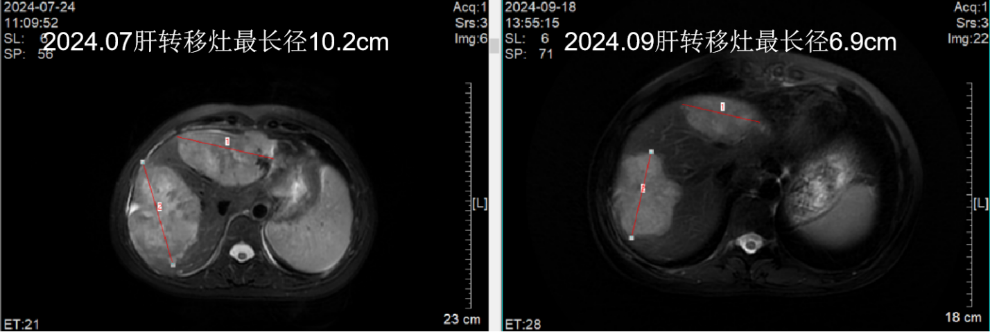 图5. 腹部CT检查.png