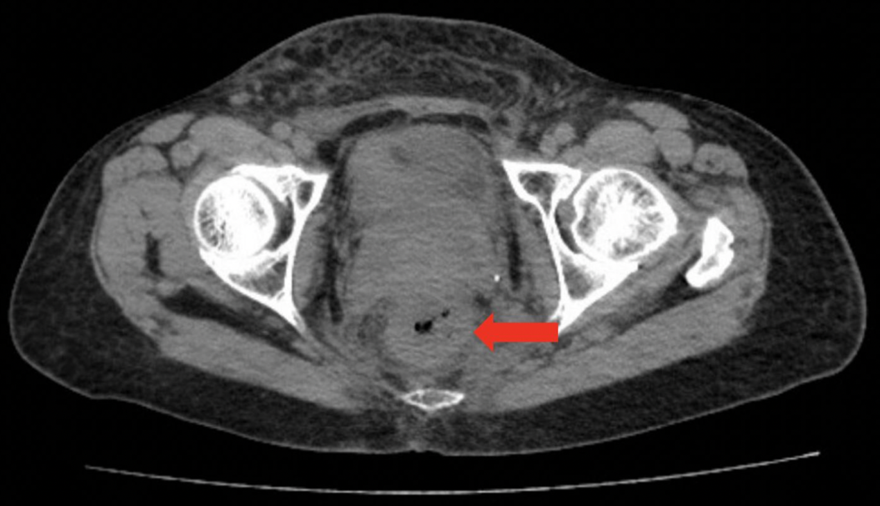 图片2.png 图片2.png