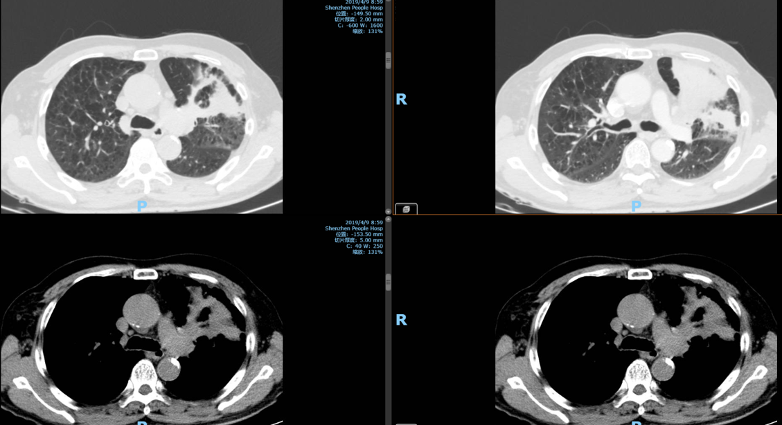 图片1.png 图片1.png