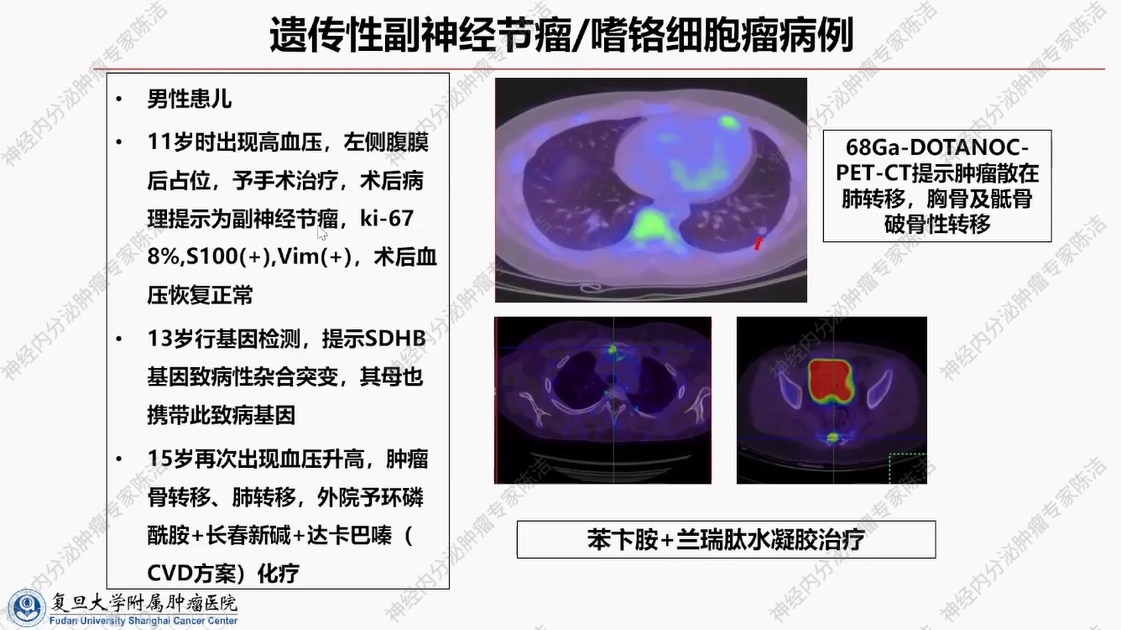 图片33.png