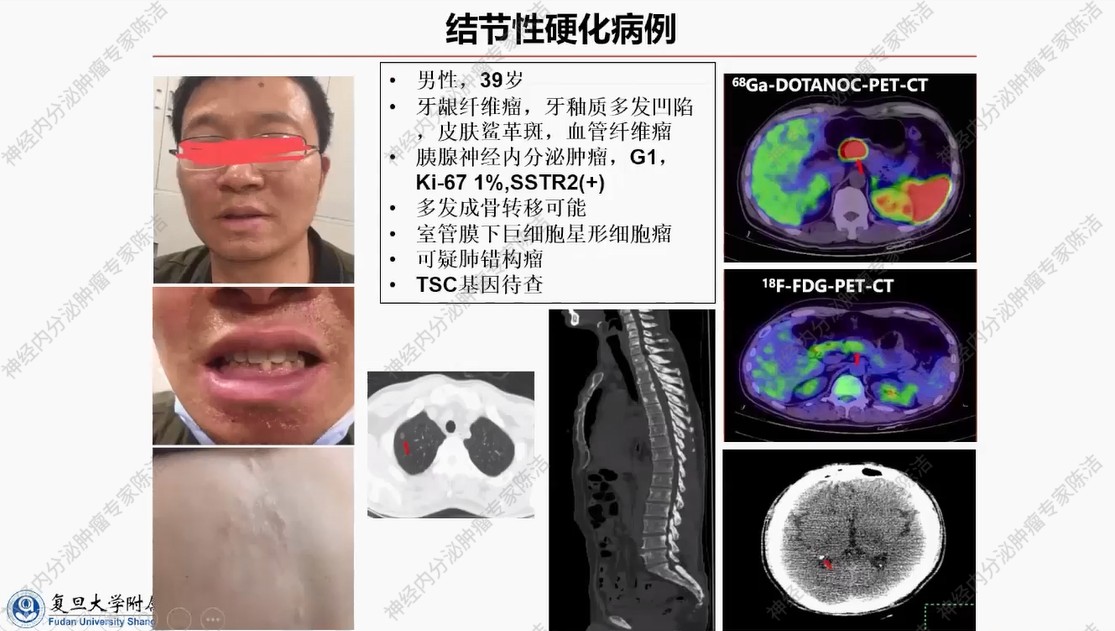 图片31.png