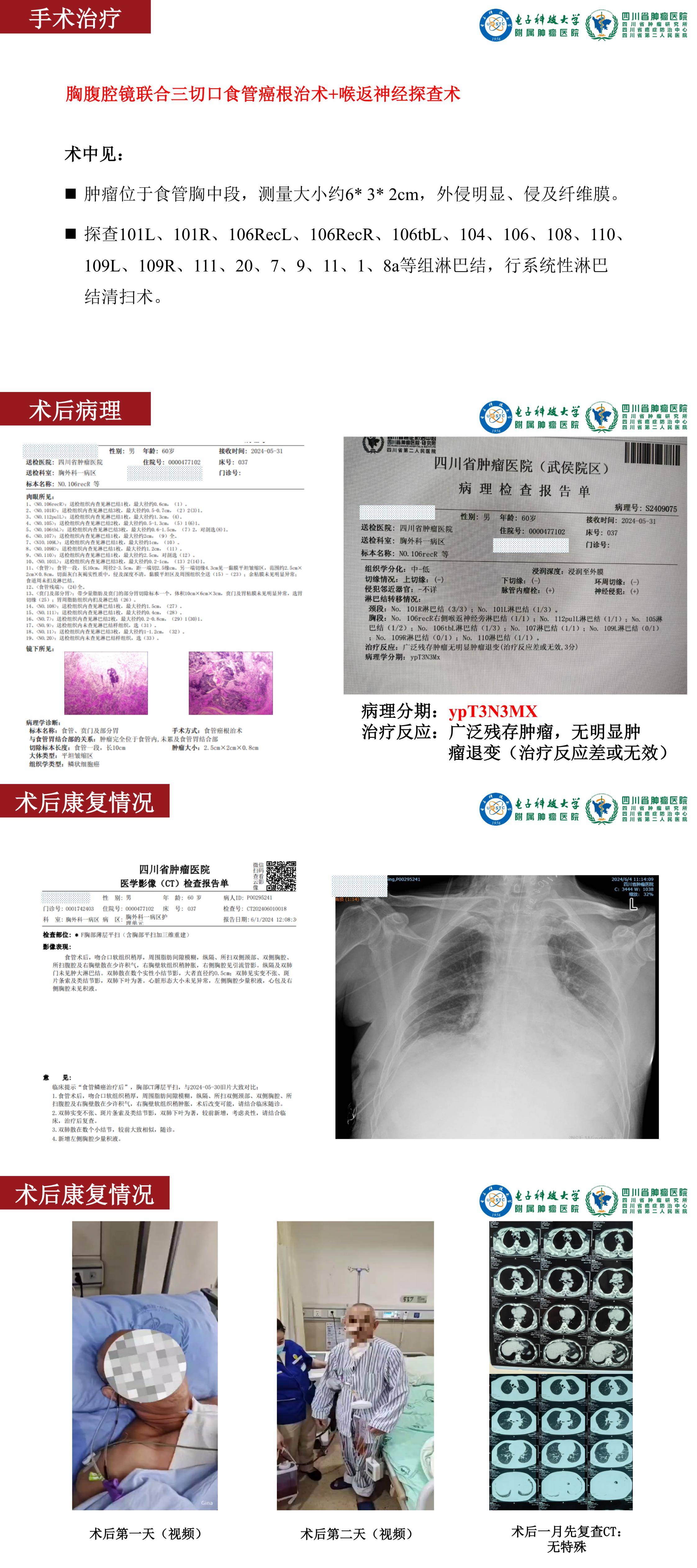 张欢 一例食管癌新辅助化免后补充放疗后行根治性手术的病例分享_00(4).jpg