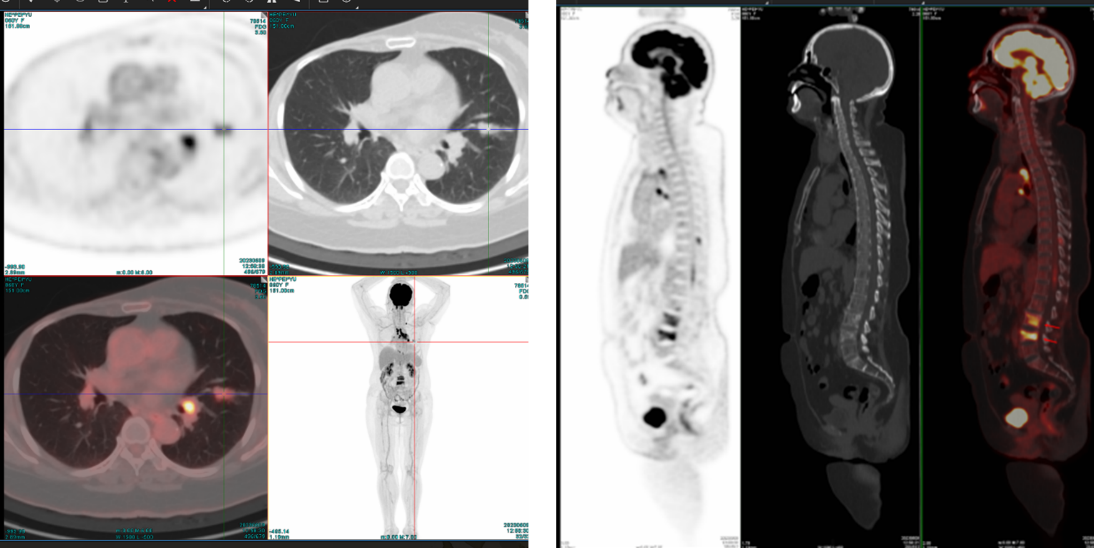 图片1.png 图片1.png