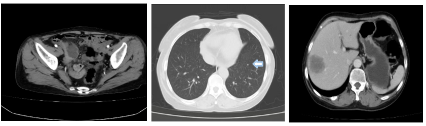 图2. CT检查.png 图2. CT检查.png