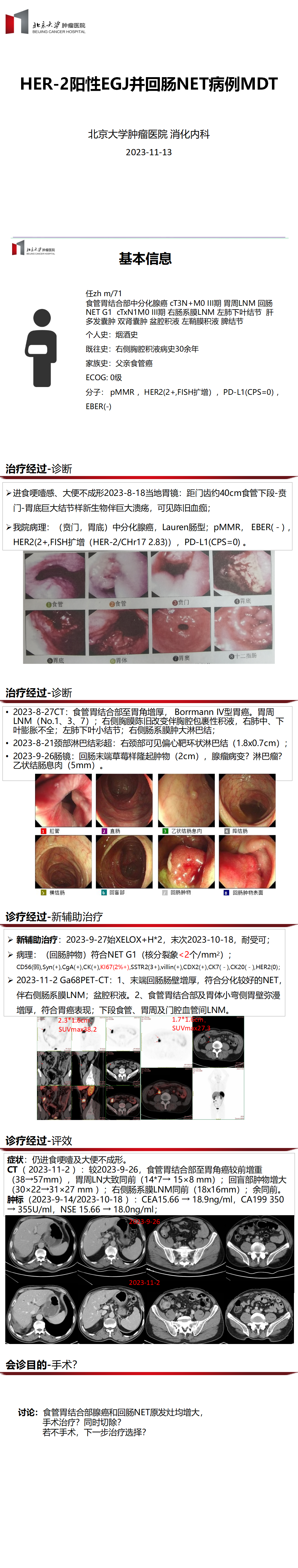 2 ren 某，食管胃结合部和回肠NET_01.png