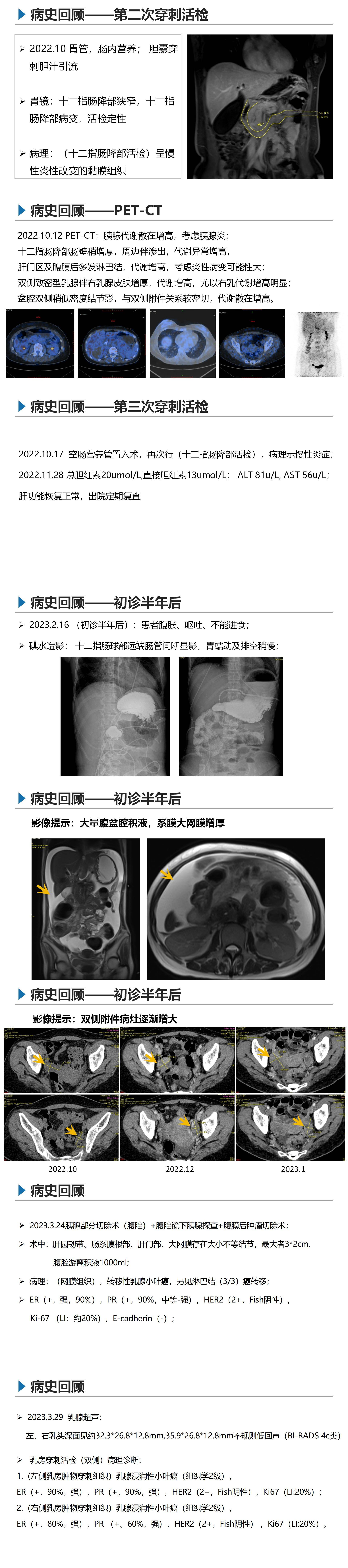 乳腺小叶癌-胡悦_01(1).jpg