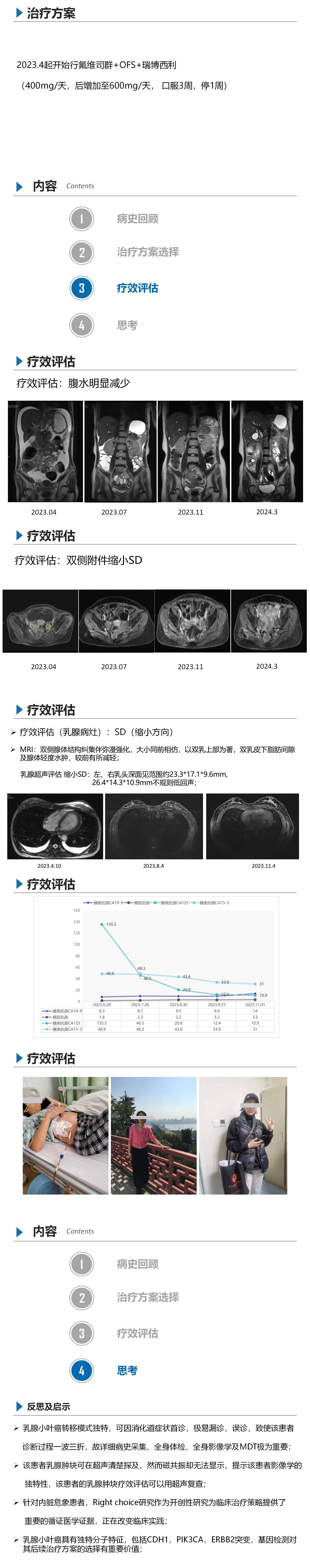 乳腺小叶癌-胡悦_01(3).jpg