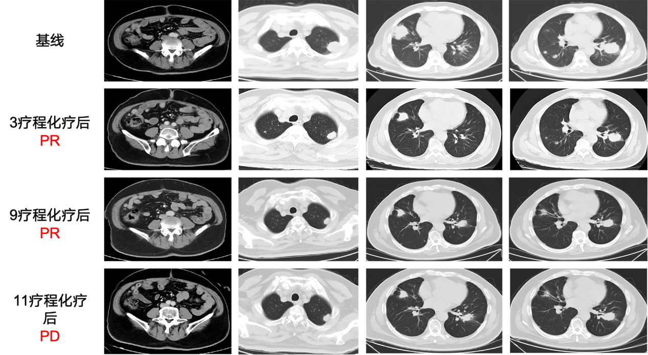 图1 影像学评估.png