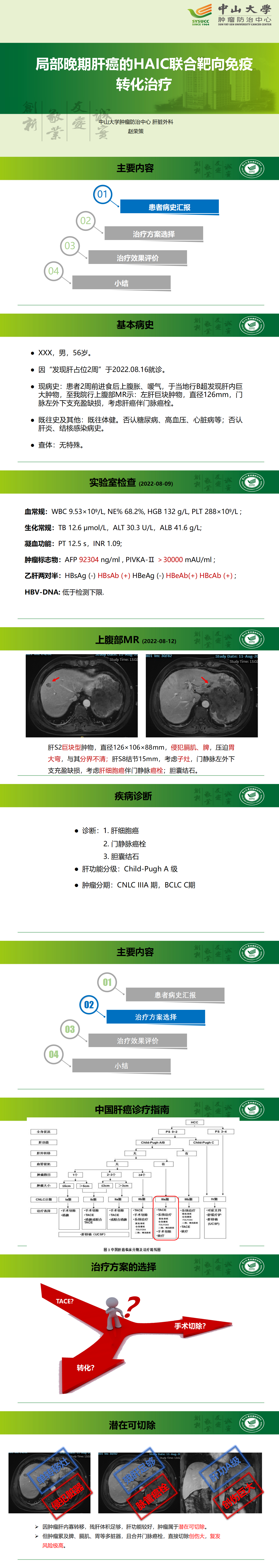 局部晚期肝癌的HAIC联合靶向免疫转化治疗_01.png