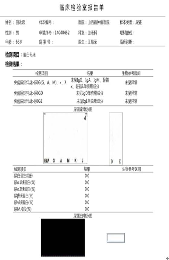 图2. 尿蛋白电泳图.png
