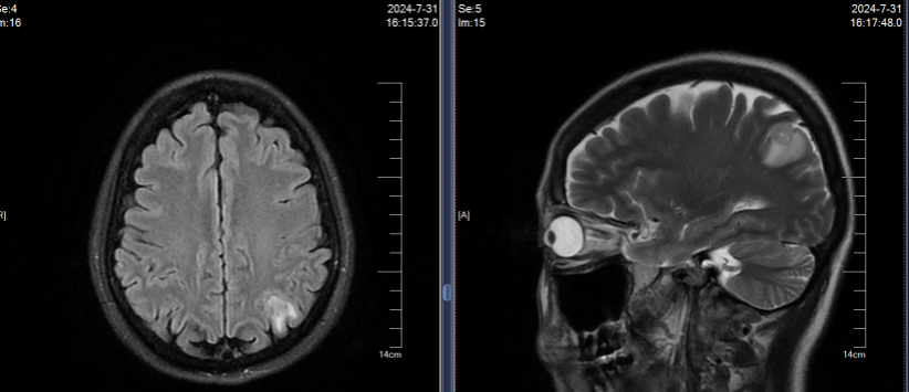 图1. 2024年7月 胸腹CT和头颅MRI检查结果.png