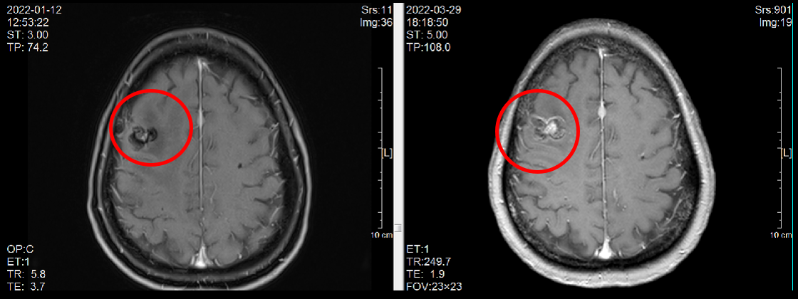 图片11.png 图片11.png