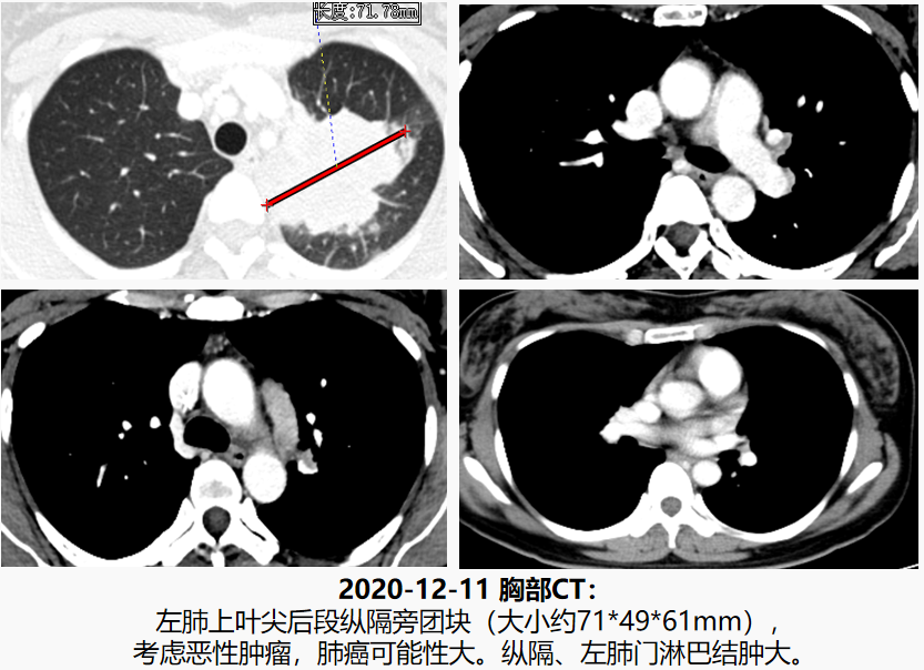 微信图片_20251103163220_1321_94.png 微信图片_20251103163220_1321_94.png