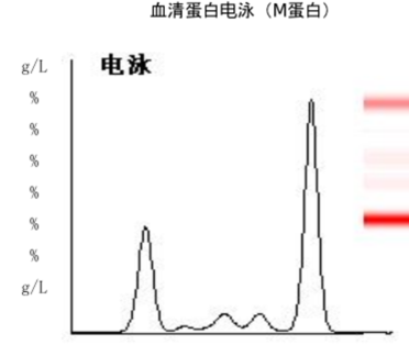 图1. 血清蛋白电泳（M蛋白）.png