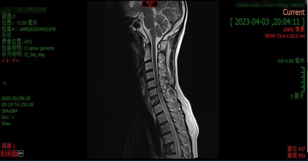 MRI（2023年4月3日）.png