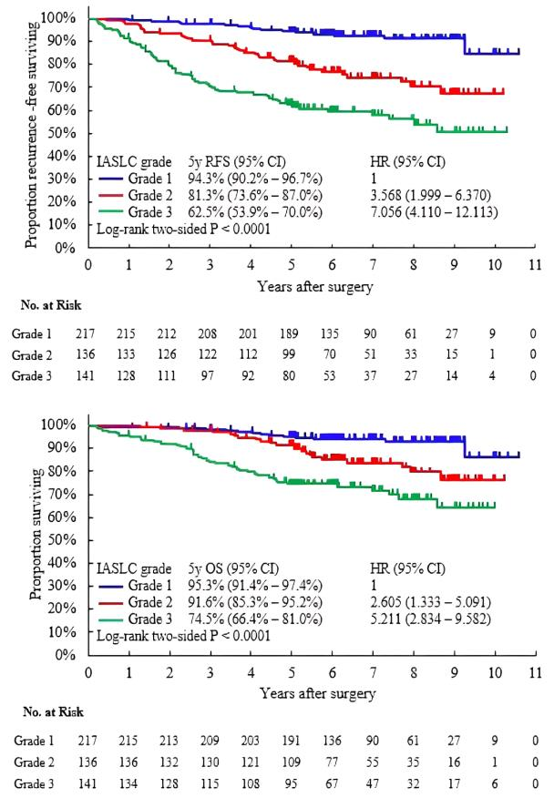 图2 不同IASLC分级的RFS和OS.png