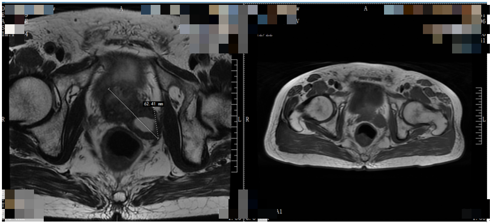 2020年10月14日影像学检查结果.png 2020年10月14日影像学检查结果.png