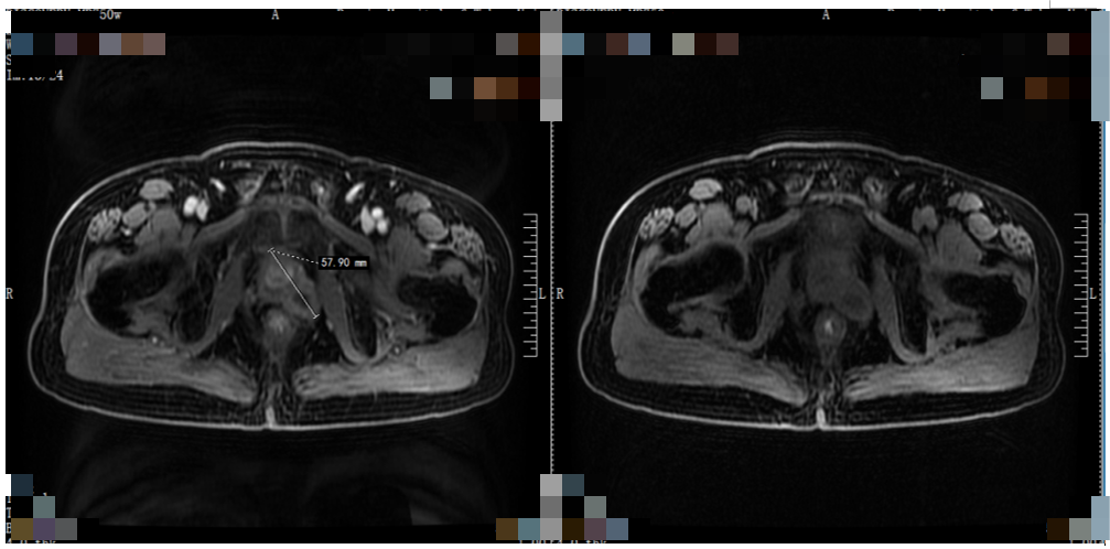 2021年04月06日影像学检查结果.png 2021年04月06日影像学检查结果.png