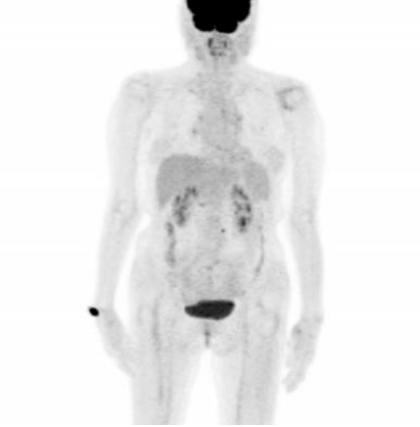 image009.png