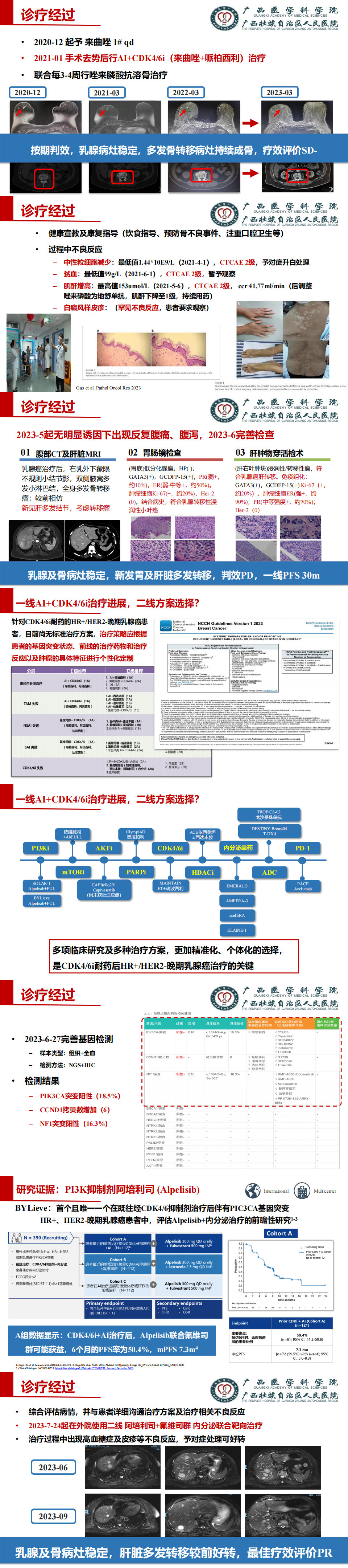 高珊-一例晚期乳腺浸润性小叶癌病例规范化诊治分享_00(4).png