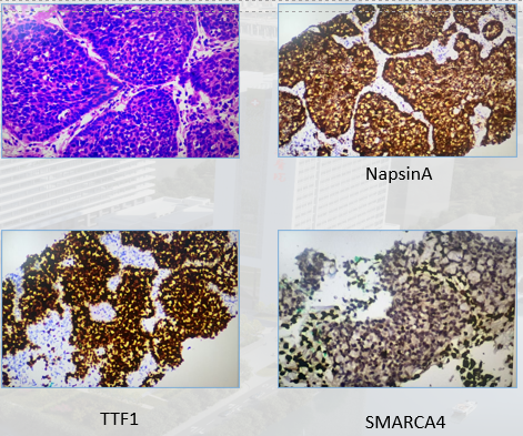 图2 病理报告.png