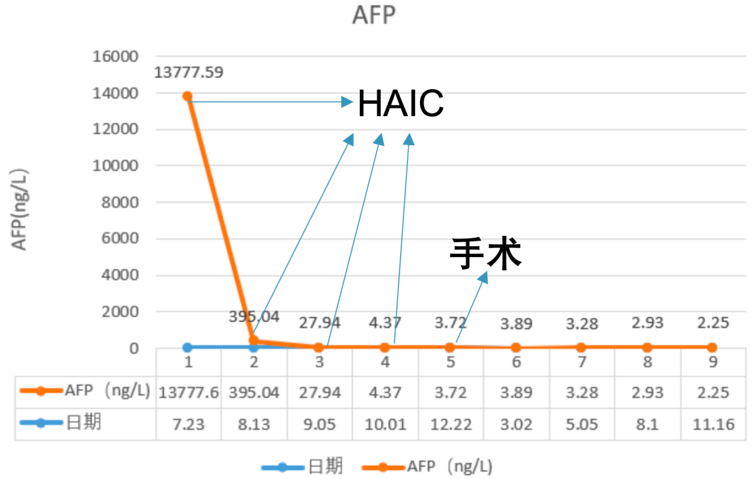 治疗期间患者AFP水平变化趋势图.png