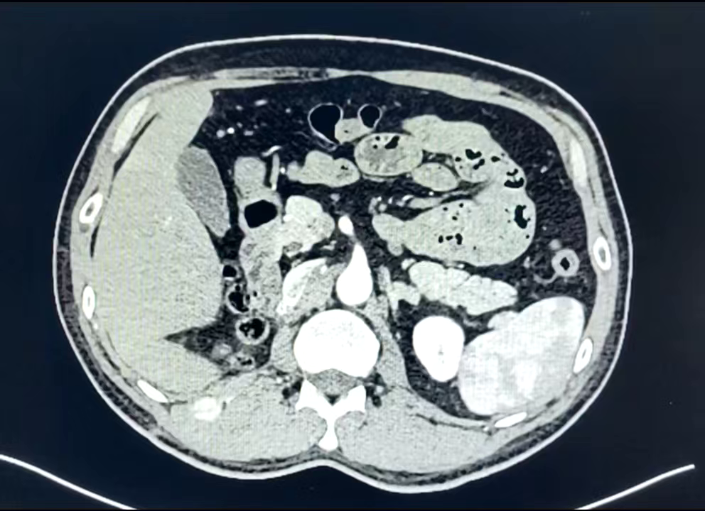 图片3.png 图片3.png