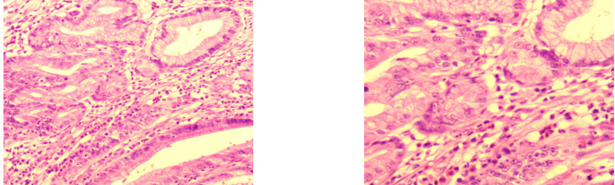 12.png