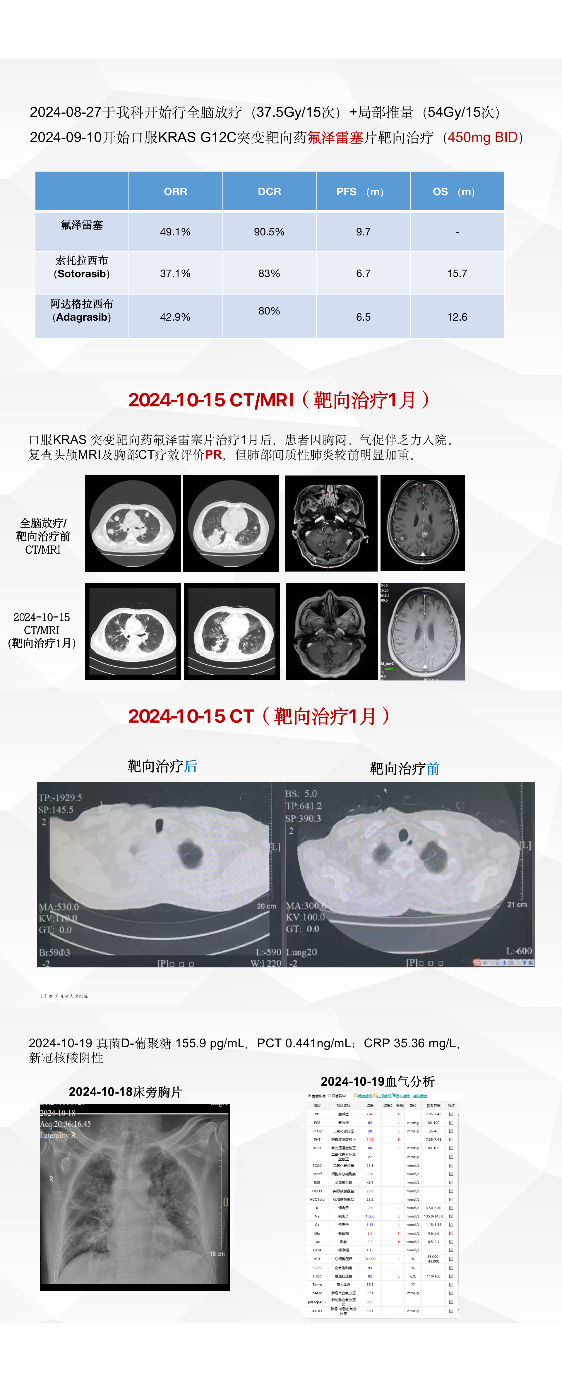 白雪医生病例-广东省医学会肺部肿瘤分会-珠海MDT.png