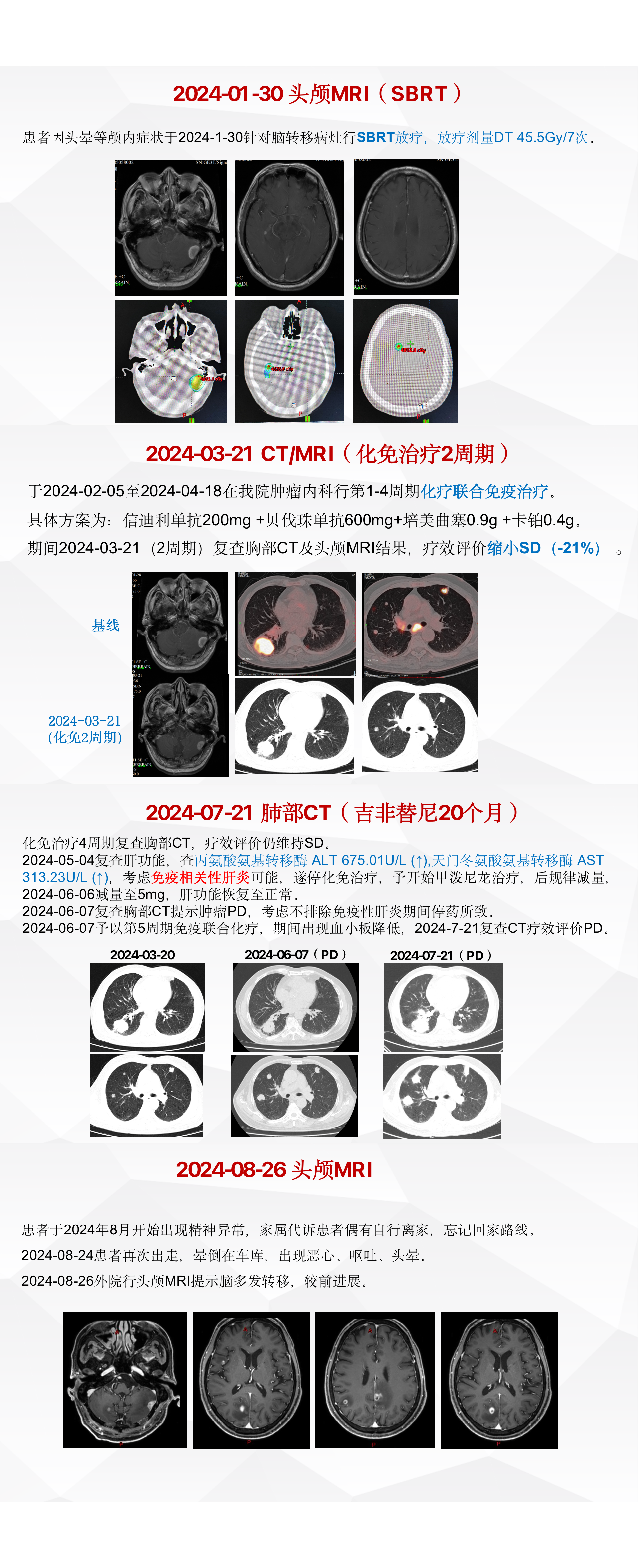 白雪医生病例-广东省医学会肺部肿瘤分会-珠海MDT.png