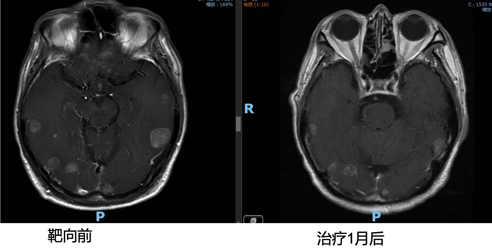 图片17.png