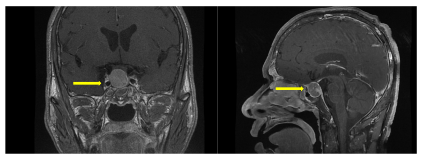 图片31.png 图片31.png