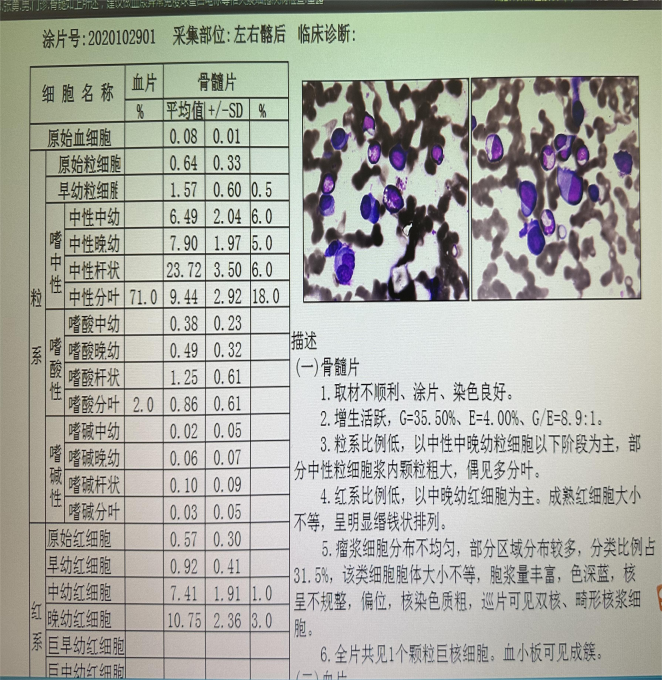 图1. 骨髓涂片.png
