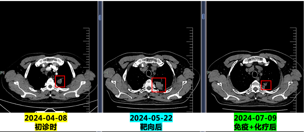 图片4.png 图片4.png