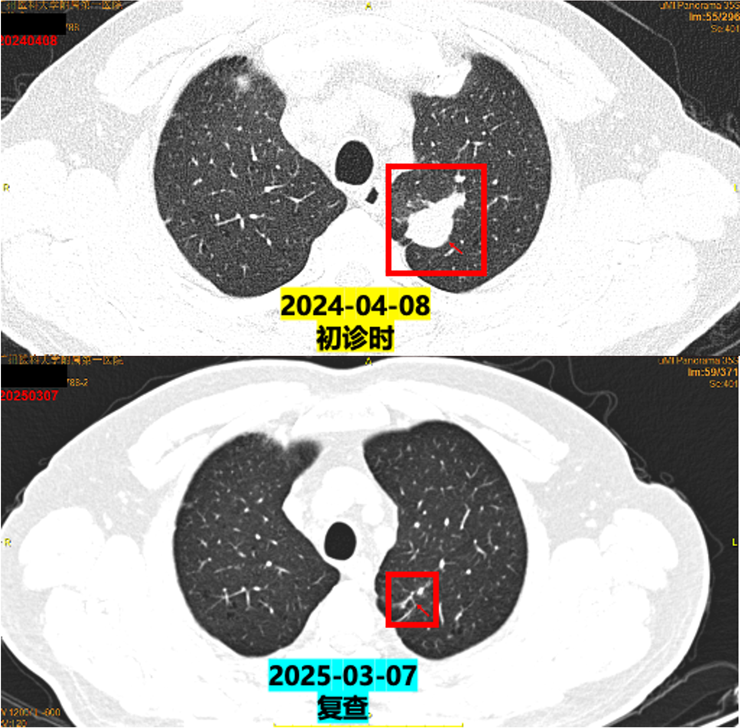 诊疗经过.png 诊疗经过.png
