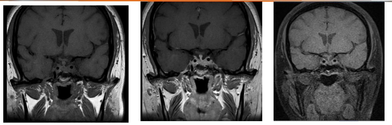 图:治疗前后影像学变化(2018-10-30至2019-8-11).png 图:治疗前后影像学变化(2018-10-30至2019-8-11).png