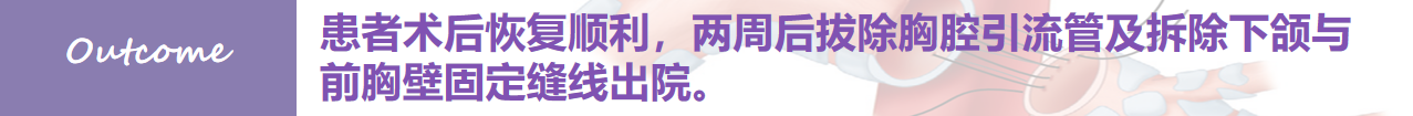 八八八八.png