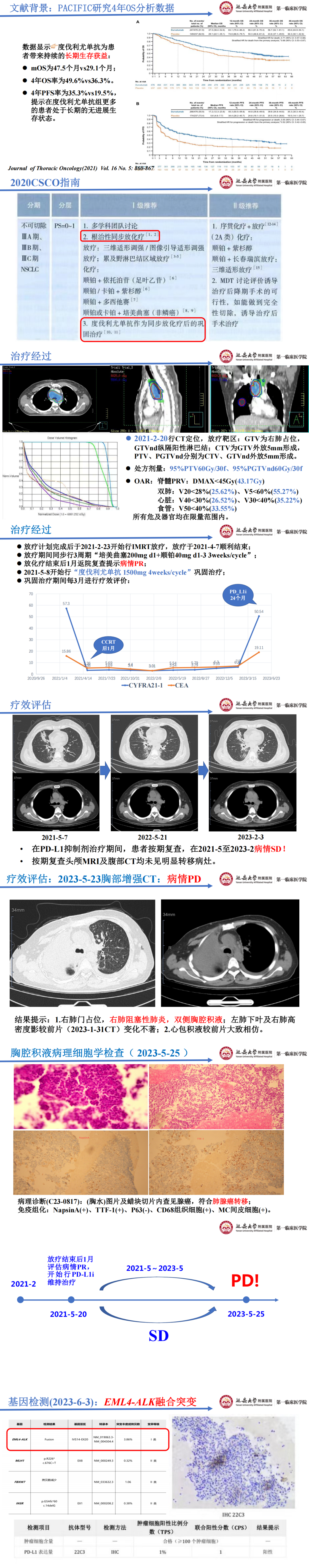 刘易婷_00(1).png