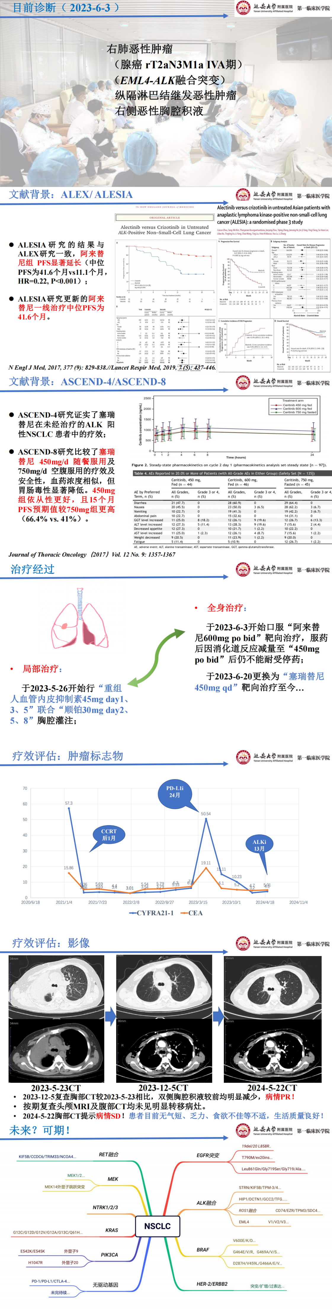 刘易婷_00(2).png