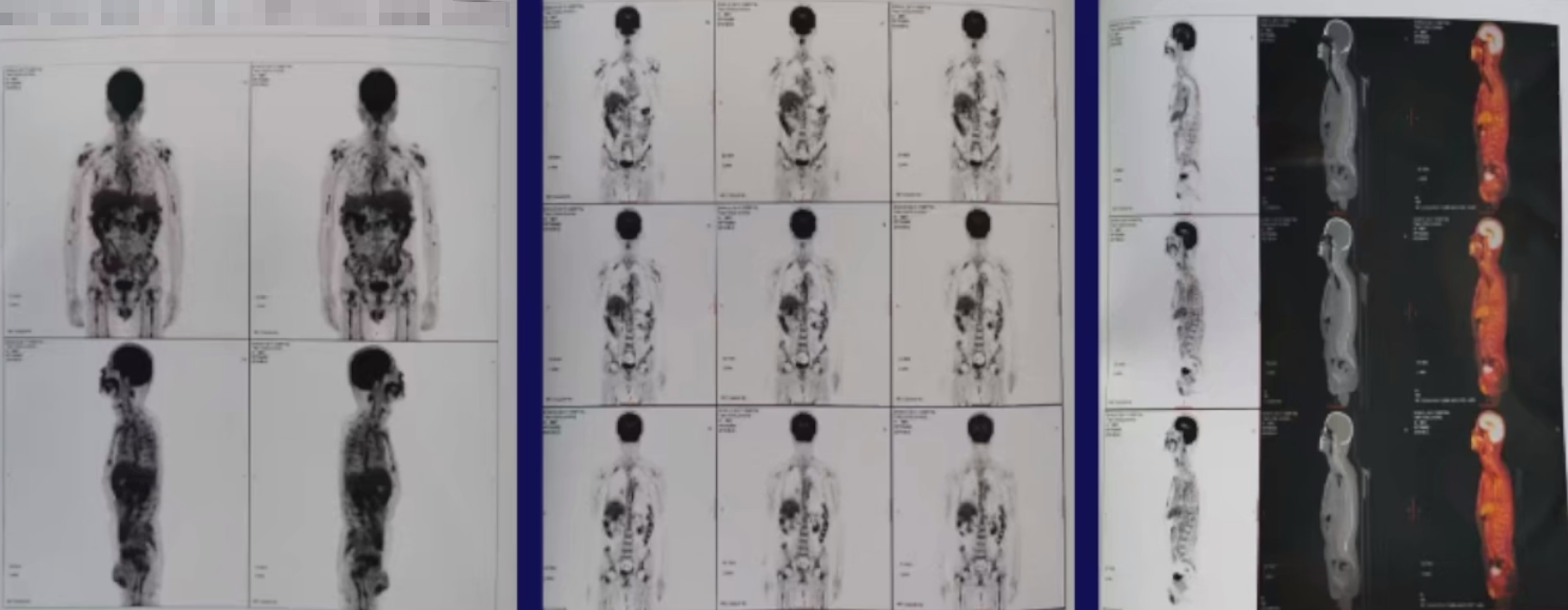 图1. PET-CT.png