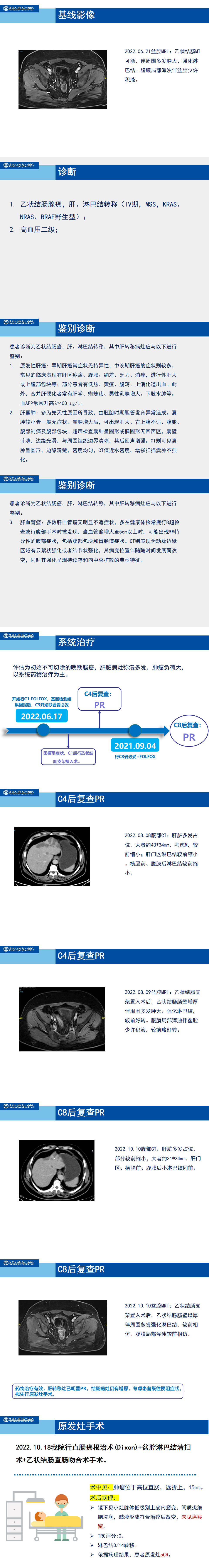 乙结肠癌肝转移转化治疗病例分享张洁筠35under35_01.png